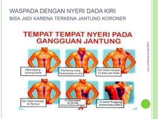 WASPADA DENGAN NYERI DADA KIRI
BISA JADI KARENA TERKENA JANTUNG KORONER




                                           yogyasehat.blogspot.com
 