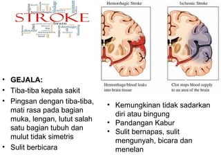 • GEJALA:
• Tiba-tiba kepala sakit
• Pingsan dengan tiba-tiba,
mati rasa pada bagian
muka, lengan, lutut salah
satu bagian tubuh dan
mulut tidak simetris
• Sulit berbicara
• Kemungkinan tidak sadarkan
diri atau bingung
• Pandangan Kabur
• Sulit bernapas, sulit
mengunyah, bicara dan
menelan
 