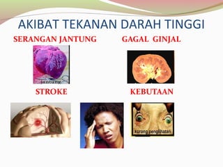 AKIBAT TEKANAN DARAH TINGGI
 