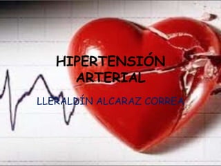HIPERTENSIÓN
ARTERIAL
LLERALDÍN ALCARAZ CORREA
 