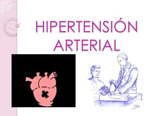 HIPERTENSIÓN
ARTERIAL
 