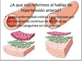 ¿A que nos referimos al hablar de
Hipertensión arterial?
• Es una enfermedad crónica caracterizada por
un incremento continuo de las cifras de
la presión sanguínea en las arterias.
 