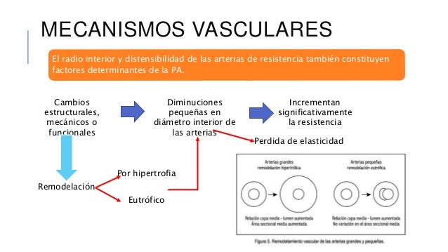 Hipertensión arterial Hipertensión arterial