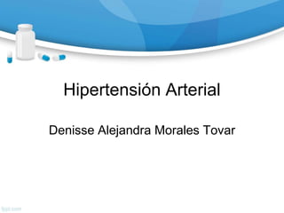 Hipertensión Arterial
Denisse Alejandra Morales Tovar
 