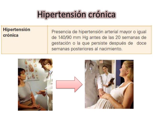 Hipertensión Arterial En El Embarazo