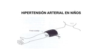 HIPERTENSIÓN ARTERIAL EN NIÑOS
 