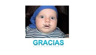 Hipertensión arterial pediatria