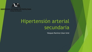 Hipertensión arterial
secundaria
Vázquez Ramírez César Uriel
 