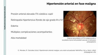 Hipertensión arterial SESIONES CLINICAS II.pptx