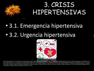 3. CRISIS 
HIPERTENSIVAS 
• 3.1. Emergencia hipertensiva 
• 3.2. Urgencia hipertensiva 
http://www.google.com.co/imgres?q=emergencia&um=1&hl=es&biw=1024&bih=466&tbm=isch&tbnid=KbuTYbnOWlBYRM:&imgrefurl=http://artilunio.blogspot.com/2008/07/eme 
rgencia-laboratorioensayo.html&docid=uCtzyieoPdDQmM&imgurl=http://3.bp.blogspot.com/_6pbU0l2l1AY/SIZO2zJTCqI/AAAAAAAABMs/s6bhMGj_YUE/s400/emergencia_copy.jpg 
&w=320&h=309&ei=asUyULPEGOie6AHn4H4AQ&zoom=1&iact=hc&vpx=573&vpy=61&dur=5&hovh=221&hovw=228&tx=100&ty=108&sig=117421512924832696914&page=1&tbnh 
=113&tbnw=115&start=0&ndsp=13&ved=1t:429,r:4,s:0,i:145 
 