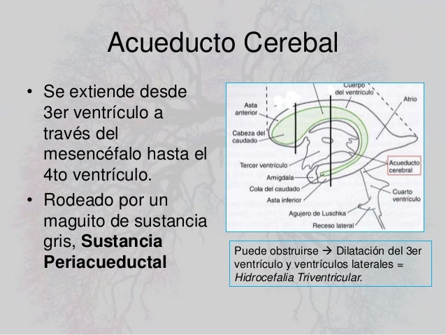 enfermedad hipertensión métodos de mejora