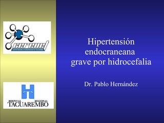 Hipertensión endocraneana  grave por hidrocefalia Dr. Pablo Hernández 