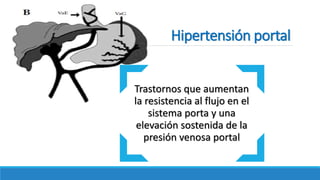Trastornos que aumentan
la resistencia al flujo en el
sistema porta y una
elevación sostenida de la
presión venosa portal
Hipertensión portal
 