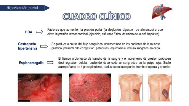 Prácticas para hipertensión causas sintomas y tratamiento