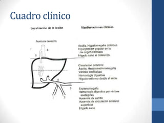 Cuadro clínico
 