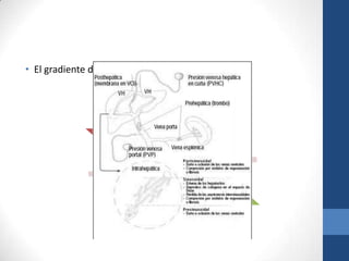 • El gradiente de presión venoso hepático




                                      PVHL



                 PVHC
 