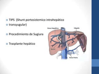  TIPS (Shunt portosistemico intrahepático
 transyugular)



   Procedimiento de Sugiura

   Trasplante hepático
 