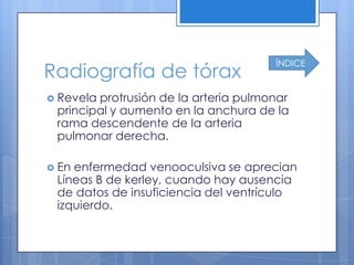 ÍNDICE
Radiografía de tórax
 Revelaprotrusión de la arteria pulmonar
 principal y aumento en la anchura de la
 rama descendente de la arteria
 pulmonar derecha.

 Enenfermedad venooculsiva se aprecian
 Líneas B de kerley, cuando hay ausencia
 de datos de insuficiencia del ventrículo
 izquierdo.
 