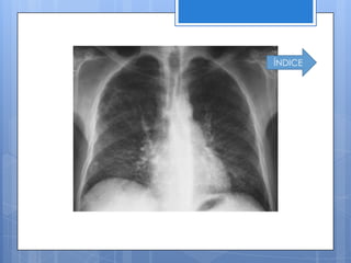 ÍNDICE
 