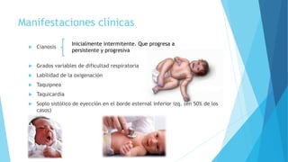 Manifestaciones clínicas
 Cianosis
 Grados variables de dificultad respiratoria
 Labilidad de la oxigenación
 Taquipnea
 Taquicardia
 Soplo sistólico de eyección en el borde esternal inferior izq. (en 50% de los
casos)
Inicialmente intermitente. Que progresa a
persistente y progresiva
 