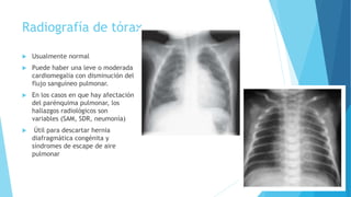 Radiografía de tórax
 Usualmente normal
 Puede haber una leve o moderada
cardiomegalia con disminución del
flujo sanguíneo pulmonar.
 En los casos en que hay afectación
del parénquima pulmonar, los
hallazgos radiológicos son
variables (SAM, SDR, neumonía)
 Útil para descartar hernia
diafragmática congénita y
síndromes de escape de aire
pulmonar
 