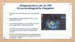 • Estima la Presión Sistólica Arterial Pulmonar
a partir de la velocidad de regurgitación de la
tricúspide + PAD

 