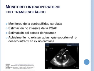 MONITOREO INTRAOPERATORIO
ECO TRANSESOFÁGICO
 Monitoreo de la contractilidad cardiaca
 Estimación no invasiva de la PSAP
 Estimación del estado de volumen
 Actualmente no existen guías que soporten el rol
del eco intraqx en cx no cardiaca
 