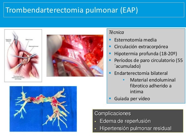 definicion hipertensión medicina natural