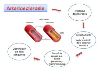 Trastorno
degenerativo
Superficie
rugosa que
atrapa
plaquetas y
macromoléculas
Disminución
del flujo
sanguíneo
Estrechamiento
y
endurecimiento
de la pared de
los vasos