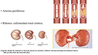 • Arterias periféricas
• Riñones: enfermedad renal crónica.
Longo DL, Kasper DL, Jameson JL, Fauci AS, Hauser SL, Loscalzo J, editores. Harrison principios de medicina interna.
18th ed. New York: Mc Graw-Hill; 2012.
 