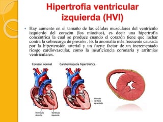  Hay aumento en el tamaño de las células musculares del ventrículo
izquierdo del corazón (los miocitos), es decir una hipertrofia
concéntrica la cual se produce cuando el corazón tiene que luchar
contra la sobrecarga de presión . Es la anomalía más frecuente causada
por la hipertensión arterial y un fuerte factor de un incrementado
riesgo cardiovascular, como la insuficiencia coronaria y arritmias
ventriculares.
 