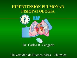 HIPERTENSIÓN PULMONAR FISIOPATOLOGIA Dr. Carlos R. Cengarle Universidad de Buenos Aires - Churruca 