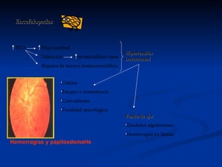 Encefalopatías HTA Flujo cerebral Dilatación  permeabilidad vasos Ruptura de barrera hematoencefálica. Hipertensión intracraneal Cefalea Estupor o somnolencia Convulsiones. Focalidad neurológica. Fondo de ojo: Exudados algodonosos. Hemorragias en llamas. Hemorragias y papiloedemaHe 