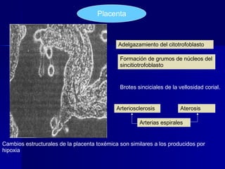 Placenta Adelgazamiento del citotrofoblasto Formación de grumos de núcleos del sincitiotrofoblasto Brotes sinciciales de l...