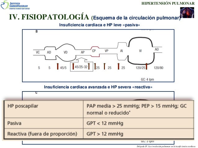 Crema para Hipertensión esencial