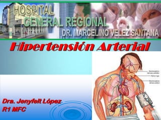Hipertensión Arterial Dra. Jenyfelt López  R1 MFC 