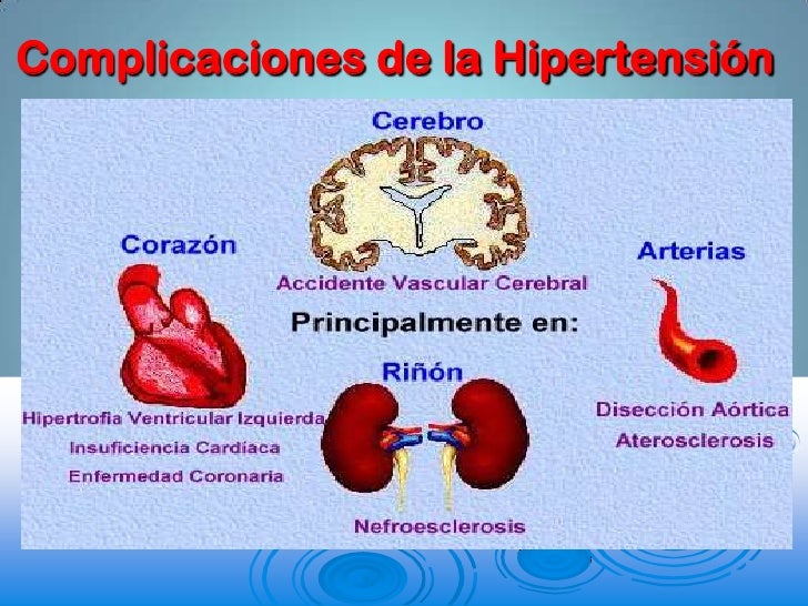 Complicaciones de la hypertension arterial pdf download