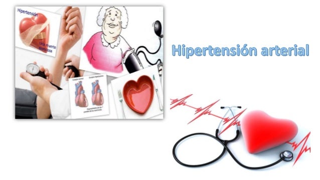 Ideas para ayudarle con caracteristicas de la hipertensión arterial