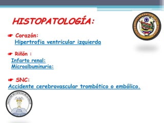 HISTOPATOLOGÍA:
☛ Corazón:
  Hipertrofia ventricular izquierda

☛ Riñón :
 Infarto renal:
 Microalbuminuria:

☛ SNC:
Accidente cerebrovascular trombótico o embólico.
 