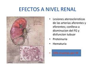 EFECTOS A NIVEL RENAL
• Lesiones ateroscleroticas
de las arterias aferentes y
eferentes; conlleva a
disminucion del FG y
disfuncion tubuar
• Proteinuria
• Hematuria
• 10% muertes por IR
 