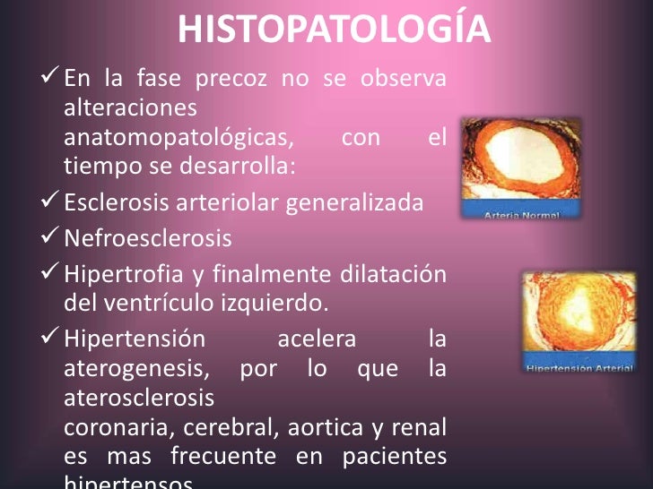 Que es hipertensión cerebral ?