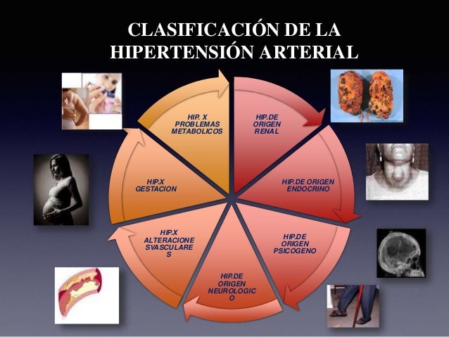 Hipertensión arterial sistemica Hipertensión arterial sistemica