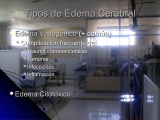 Tipos de Edema CerebralTipos de Edema Cerebral
Edema VasogénicoEdema Vasogénico (+ común)(+ común)
Complicación frecuente de:Complicación frecuente de:
 Trauma craneoencefálicoTrauma craneoencefálico
 TumoresTumores
 InfeccionesInfecciones
 InflamaciónInflamación
Edema CitotóxicoEdema Citotóxico
 