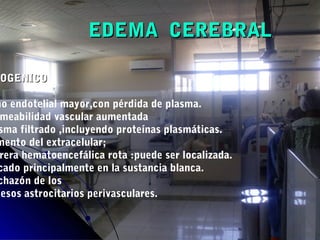 EDEMA CEREBRALEDEMA CEREBRAL
SOGENICOOGENICO
ño endotelial mayor,con pérdida de plasma.
meabilidad vascular aumentada
sma filtrado ,incluyendo proteínas plasmáticas.
mento del extracelular;
rera hematoencefálica rota :puede ser localizada.
cado principalmente en la sustancia blanca.
chazón de los
cesos astrocitarios perivasculares.
 