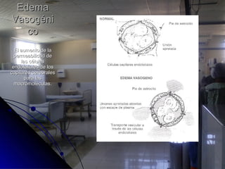 El aumento de laEl aumento de la
permeabilidad depermeabilidad de
las célulaslas células
endoteliales de losendoteliales de los
capilares cerebralescapilares cerebrales
para laspara las
macromoléculas.macromoléculas.
EdemaEdema
VasogéniVasogéni
coco
 