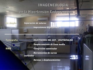 IMAGENEOLOGÍAIMAGENEOLOGÍA
en la Hipertensión Endocraneanaen la Hipertensión Endocraneana
Rx simple:Rx simple: Separación de suturasSeparación de suturas
Impresioness digitiformesImpresioness digitiformes
TomografíaTomografía DILATACION DEL SIST. VENTRICULARDILATACION DEL SIST. VENTRICULAR
Desplazamiento de línea mediaDesplazamiento de línea media
RMNRMN Compresión ventricularCompresión ventricular
Borramientos de surcosBorramientos de surcos
corticalescorticales
Hernias y desplazamientosHernias y desplazamientos
 
