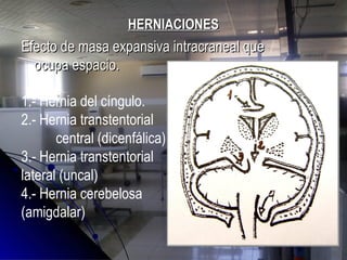 HERNIACIONESHERNIACIONES
Efecto de masa expansiva intracraneal queEfecto de masa expansiva intracraneal que
ocupa espacio.ocupa espacio.
1.- Hernia del cíngulo.
2.- Hernia transtentorial
central (dicenfálica)
3.- Hernia transtentorial
lateral (uncal)
4.- Hernia cerebelosa
(amigdalar)
 