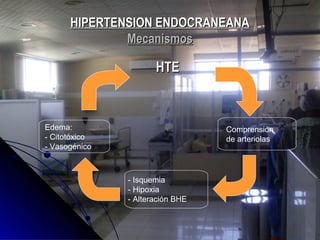 HIPERTENSION ENDOCRANEANAHIPERTENSION ENDOCRANEANA
MecanismosMecanismos
HTEHTE
Edema:
- Citotóxico
- Vasogénico
Comprensión
de arteriolas
- Isquemia
- Hipoxia
- Alteración BHE
 