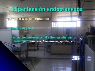 Hipertensión endocraneanaHipertensión endocraneana
TRATAMIENTO QUIRÚRGICOTRATAMIENTO QUIRÚRGICO
Drenaje de L C RDrenaje de L C R
Evacuación quirúrgica del volumen adicionalEvacuación quirúrgica del volumen adicional
patológico:patológico: tumores, hematomas, quistes, etc.tumores, hematomas, quistes, etc.
 