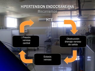 HIPERTENSION ENDOCRANEANAHIPERTENSION ENDOCRANEANA
MecanismosMecanismos
HTEHTE
 Presión
venosa
central
Obstrucción
drenaje venoso
de salida
Estasis
venoso
 